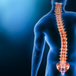 Can Chiropractic Care Help Scoliosis